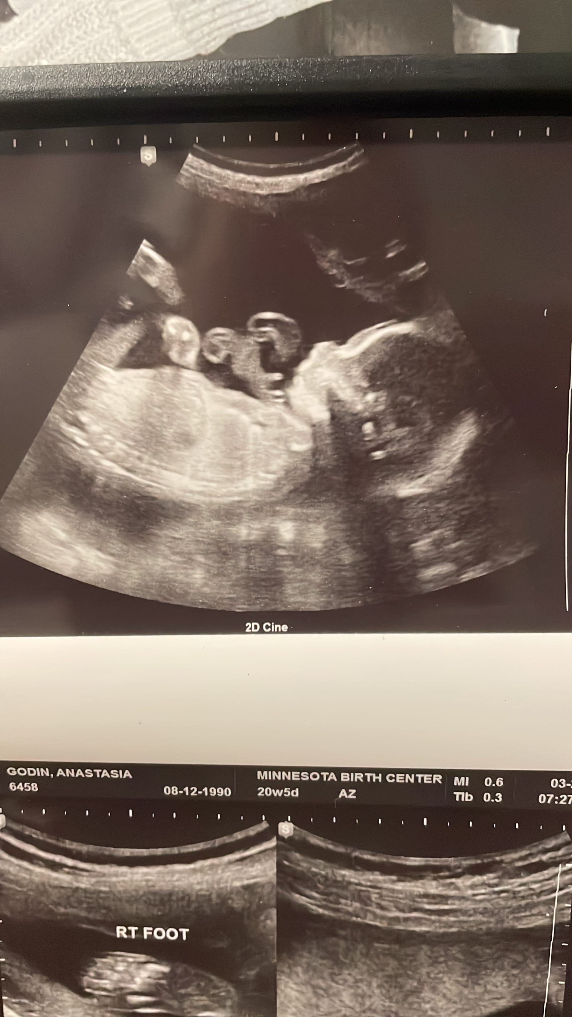 The Birth of Porter